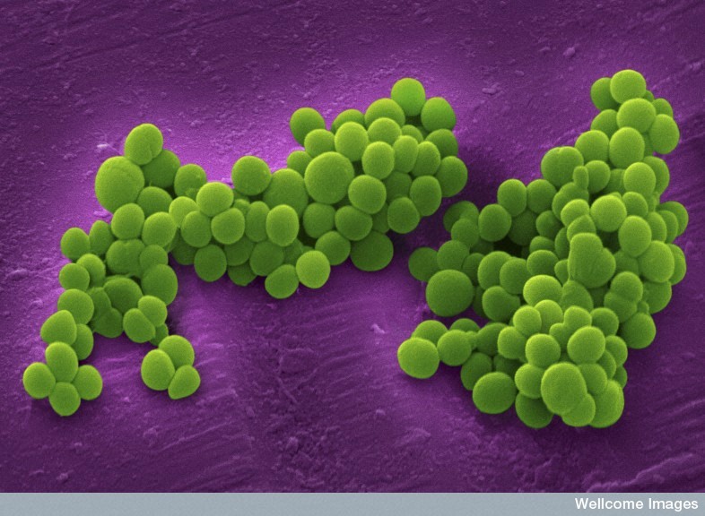 MRSA 'super bug'